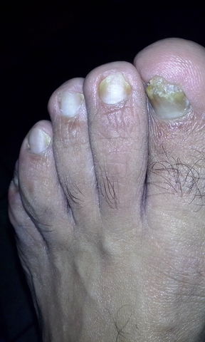despues del pedicure