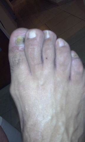 despues del pedicure